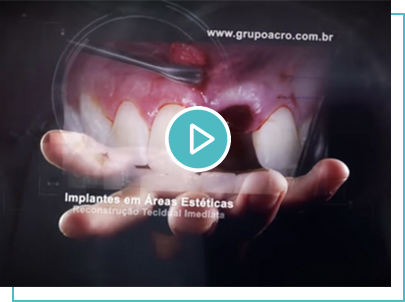 vídeo